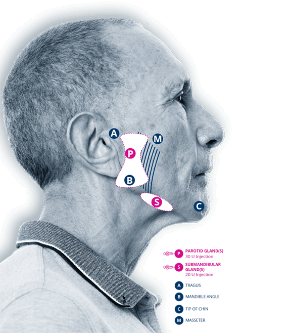 XEOMIN® videos labelled diagram